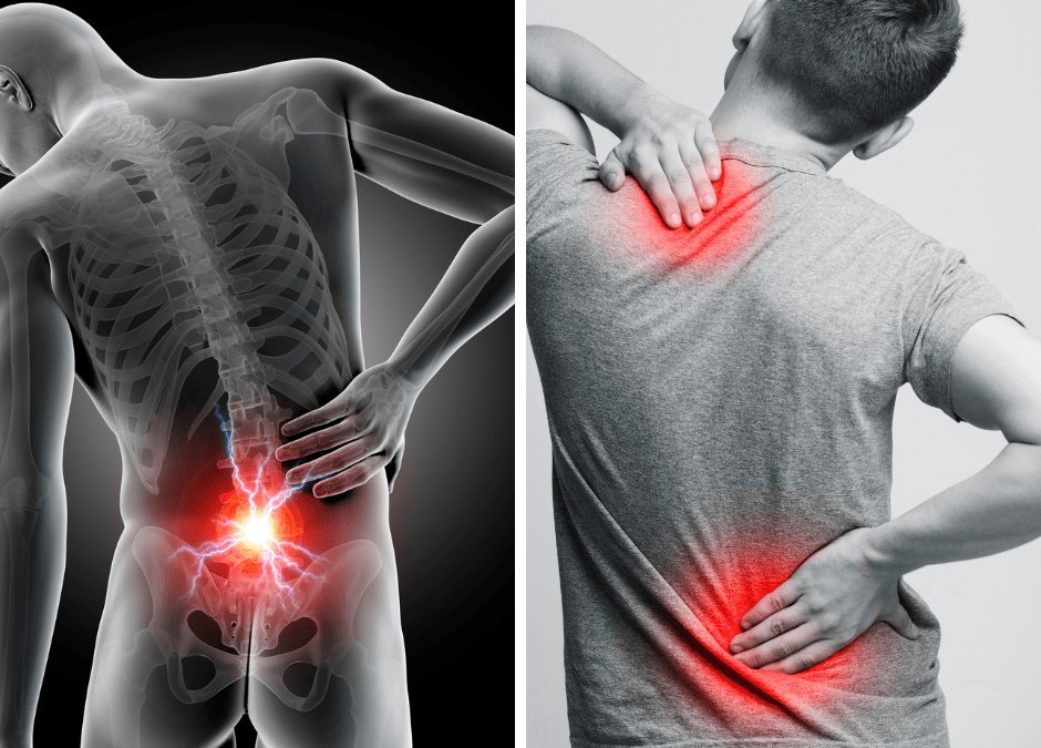 Dolor de espalda ¿Qué consecuencias tiene la mala postura corporal?